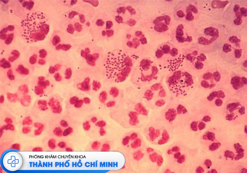 10-cach-chua-benh-lau-cho-nam-gioi-tai-nha