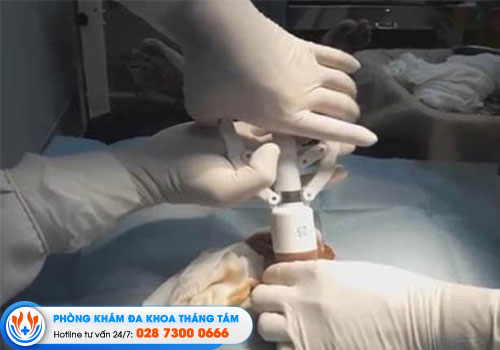 8-dia-chi-cat-bao-quy-dau-quan-binh-thanh-uy-tin-an-toan