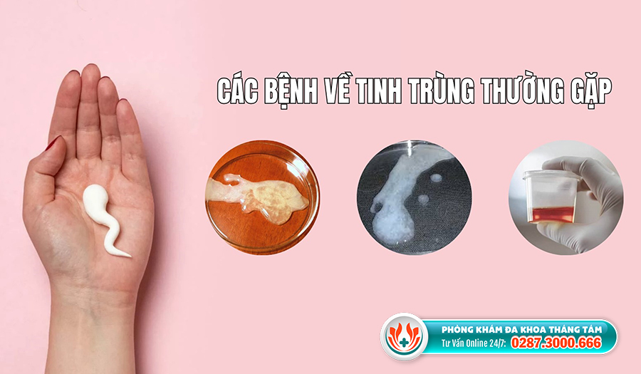 Mẹo vặt làm đẹp: Các bệnh về tinh trùng thường gặp và cách nhận biết Cac-benh-tinh-trung-thuong-gap