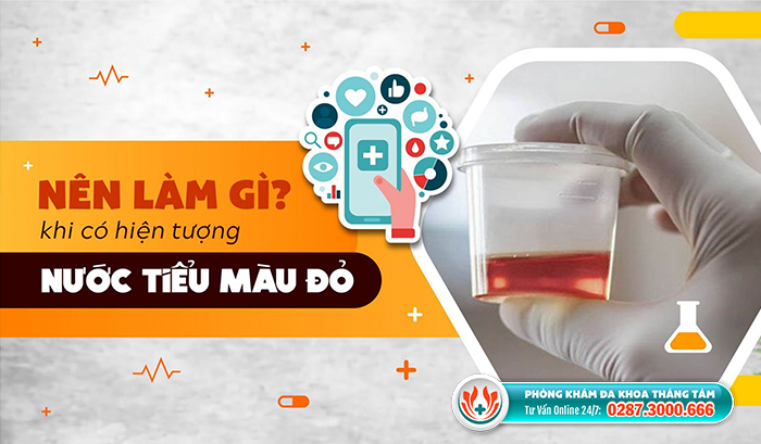 Chẩn đoán tình trạng nước tiểu màu đỏ
