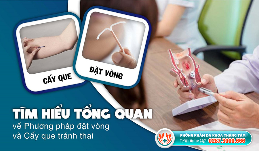 Đặt vòng và cấy que đều có ưu, nhược điểm riêng