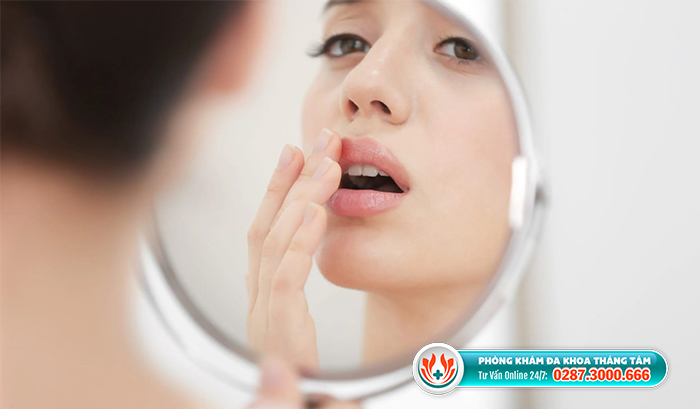 Phương pháp điều trị mụn rộp ở môi là gì?
