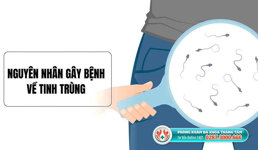 Có nhiều nguyên nhân gây bệnh tinh trùng, từ các yếu tố sinh lý đến các yếu tố môi trường