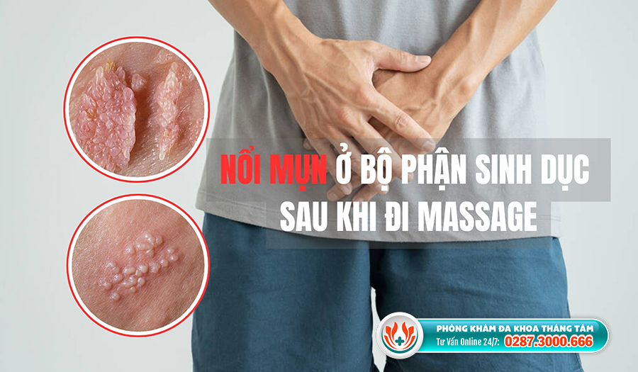 noi-mun-o-bo-phan-sinh-duc-sau-khi-di-massage.jpg