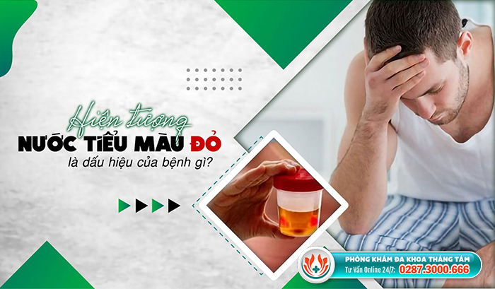 Mẹo vặt làm đẹp: Địa chỉ điều trị nước tiểu màu đỏ uy tín tại TPHCM Nuoc-tieu-mau-do-canh-bao-benh-gi