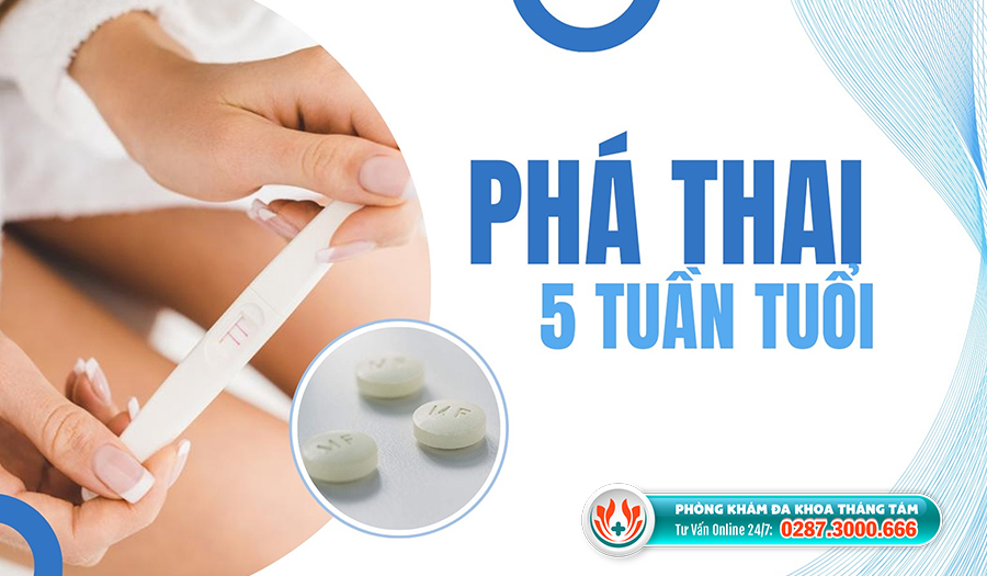 Những điều cần biết khi phá thai 5 tuần tuổi ở TPHCM