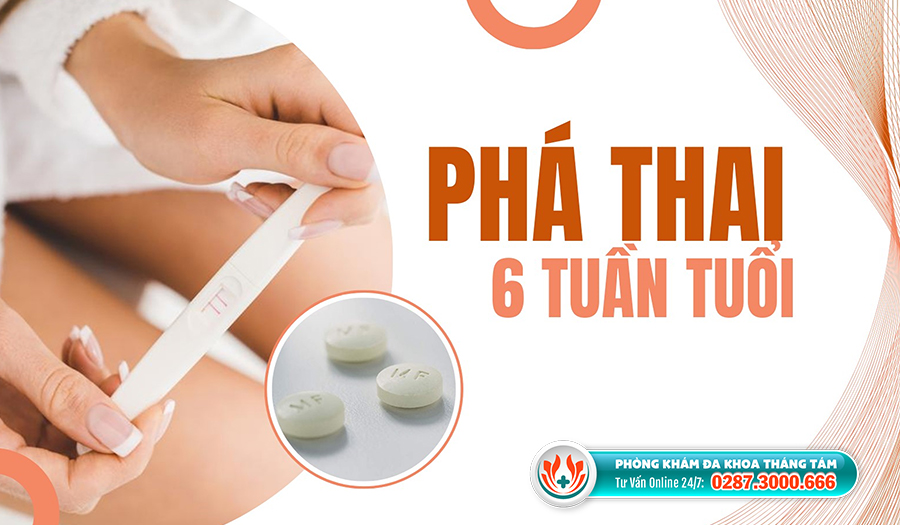 Những điều cần biết khi phá thai 6 tuần tuổi ở TPHCM