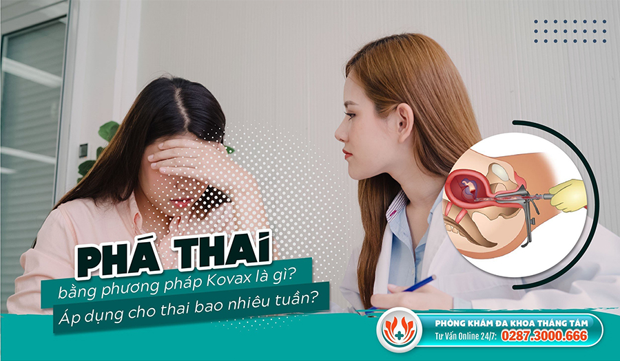 Thông tin cần biết về Phương pháp phá thai Kovax