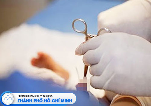 review-cat-bao-quy-dau-benh-vien-binh-dan-tung-buoc