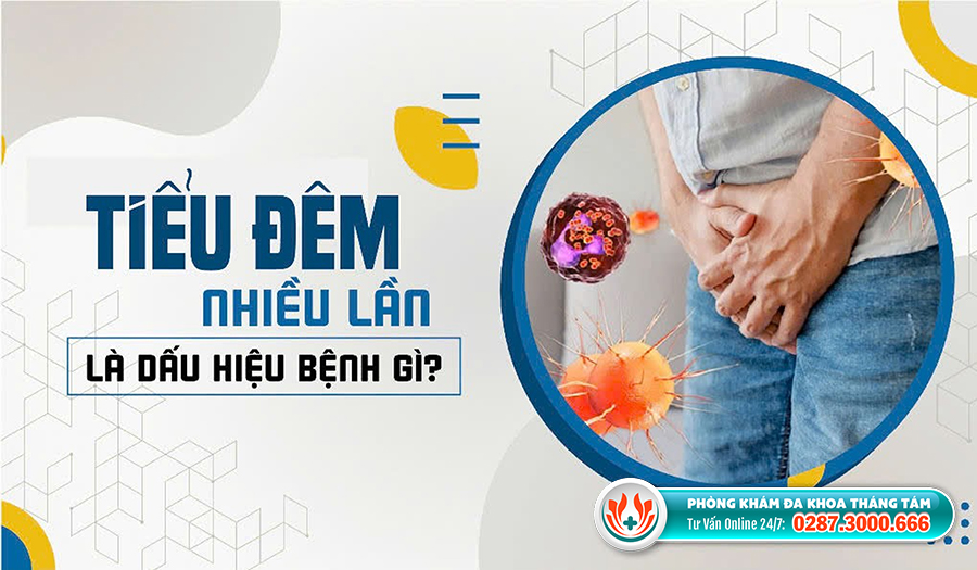 Đi tiểu nhiều lần vào ban đêm là dấu hiệu của bệnh gì?