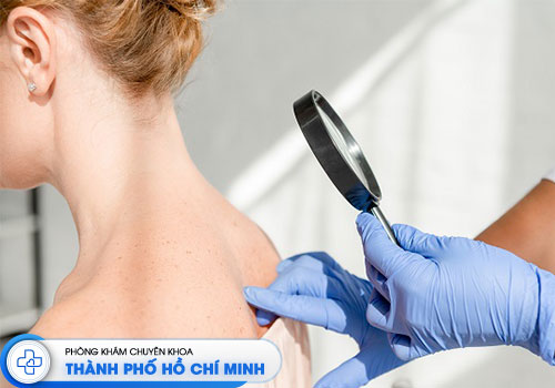 top-10-phong-kham-da-lieu-tai-tphcm-uy-tin