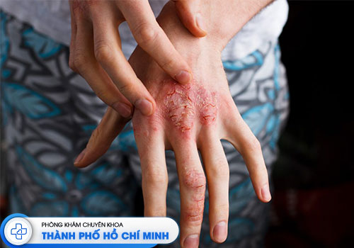 top-10-phong-kham-da-lieu-tai-tphcm-uy-tin