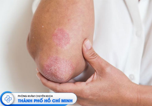 top-5-bac-si-da-lieu-tri-cham-gioi-o-tphcm