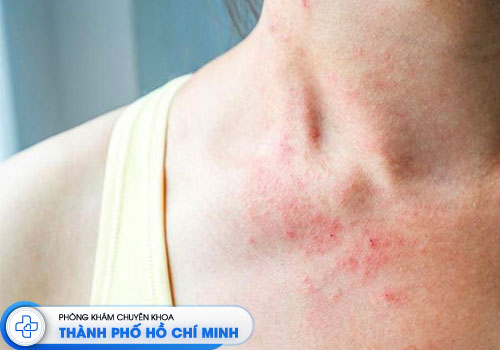 top-6-bac-si-chua-viem-da-co-dia-gioi-tphcm