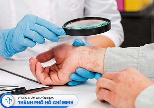 top-6-bac-si-chua-viem-da-co-dia-gioi-tphcm