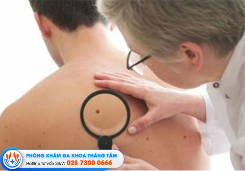 top-6-phong-kham-da-lieu-quan-6-co-bac-si-gioi