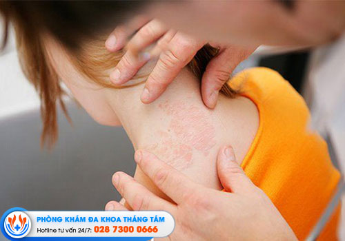 top-6-phong-kham-da-lieu-quan-6-co-bac-si-gioi