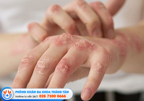 top-9-phong-kham-da-lieu-o-nha-be-chat-luong
